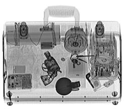 Black & white x-ray image-gsautomatic.com Black & white x-ray image-gsautomatic.com